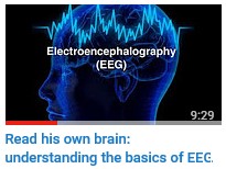 Read his own brain: understanding the basics of EEG